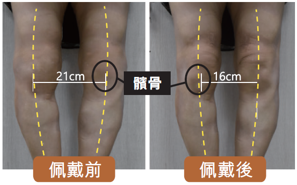 病人成效見證